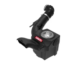 Takeda Momentum Cold Air Intake System w/ Pro DRY S Filter Ford Fiesta ST L4-1.6L t 2014-2015