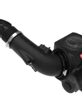 Takeda Momentum Cold Air Intake System w/ Pro DRY S Filter Ford Fiesta ST L4-1.6L t 2014-2015                                     - 56-70022D - Image 4