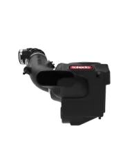 Takeda Momentum Cold Air Intake System w/ Pro DRY S Filter Ford Fiesta ST L4-1.6L t 2014-2015                                     - 56-70022D - Image 5