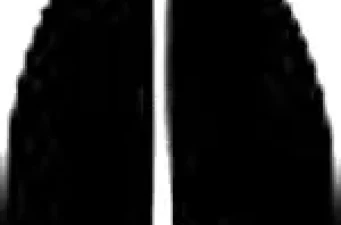 Body | Aero Parts